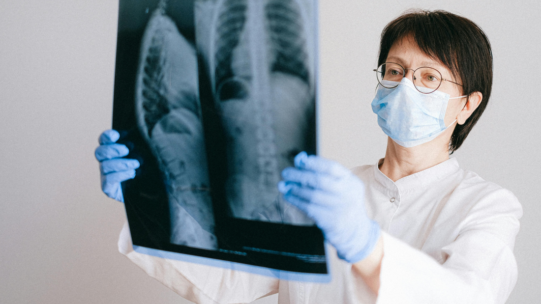 ¿Cómo se detecta una enfermedad pulmonar?