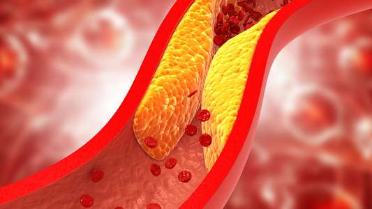 Enfermedades genéticas: Hipercolesterolemia Familiar